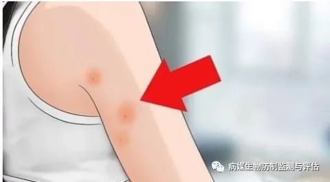 灭臭虫的药_灭臭虫用什么药最好_杀臭虫药排行榜