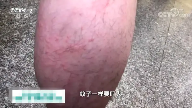 灭蚊子神器测评_灭蚊神器怎么样_灭蚊神器工作原理