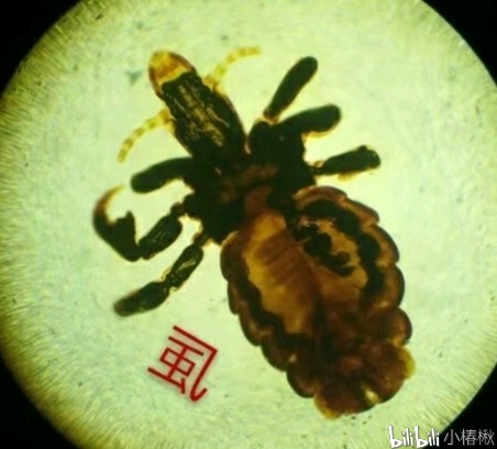 跳蚤的卵_跳蚤的卵_跳蚤的卵