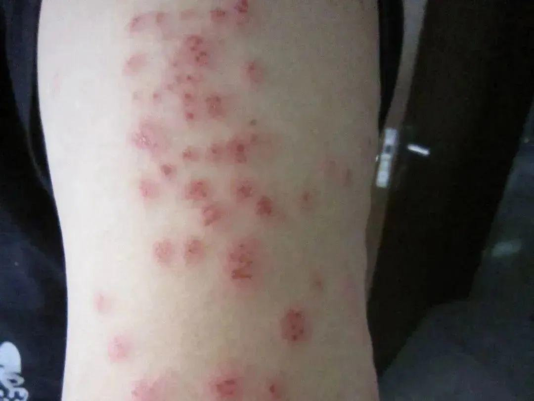 灭臭虫呋虫胺_呋虫胺可以杀死臭虫吗_杀臭虫药剂