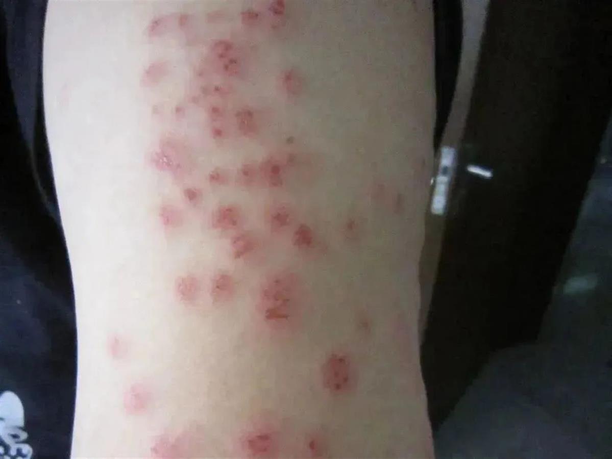 灭臭虫药_臭虫呋虫胺_灭臭虫呋虫胺
