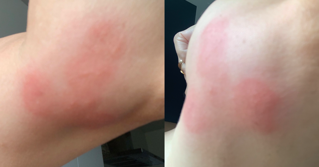 臭臭虫_臭狗熊臭狗熊_臭臭虫动画片开始