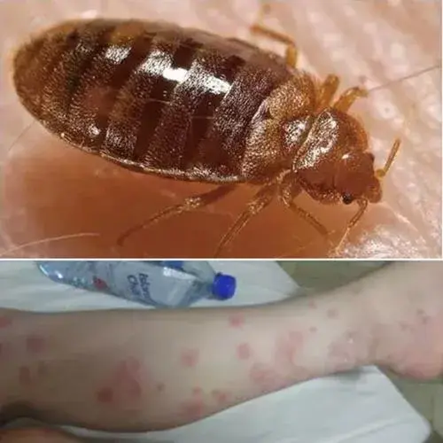 灭臭虫用什么药最有效_灭药臭虫有效用什么代替_灭药臭虫有效用什么药